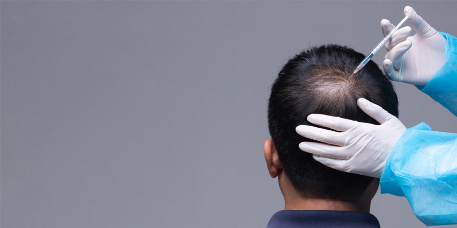 Best Skin and Hair Specialist in Bangalore: PRP Hair Loss Treatment & Dermatology Care Explained