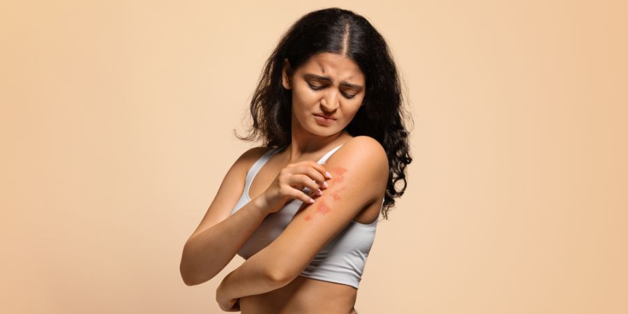 Fungal Infection: Causes, Symptoms, and Effective Treatment | Best Dermatologist in Jayanagar