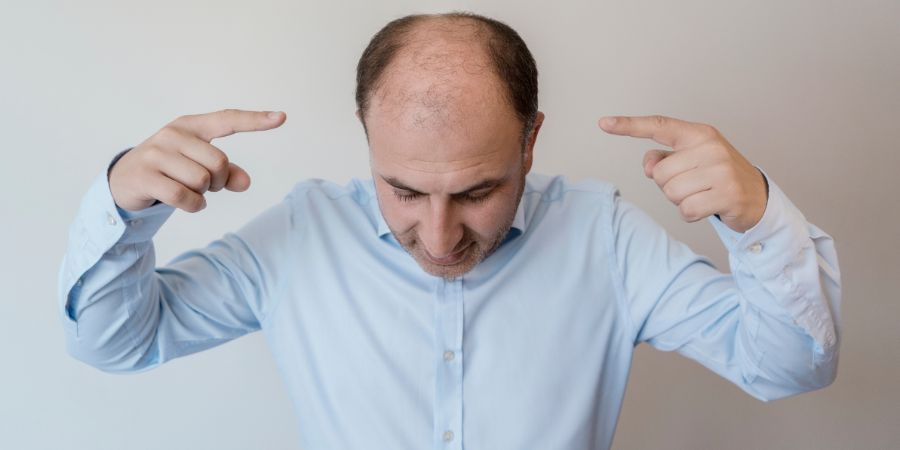 Male Pattern Baldness: Effective Solutions with the Best Dermatologist in Jayanagar