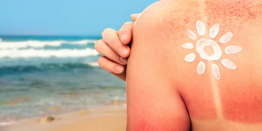 Premature Aging of Skin Due to Sun Damage: Causes, Prevention & Treatment | Premature Aging Skin Treatment in Bangalore