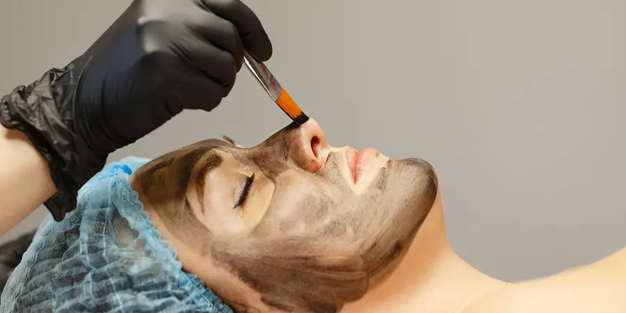 Carbon Laser Peel Before and After: What Results Are Realistic? | Carbon Laser Treatment in BTM Layout